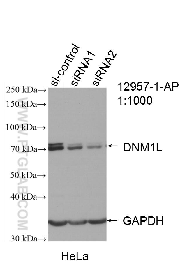 DRP1 (C-terminal) Antibody in Western Blot (WB)