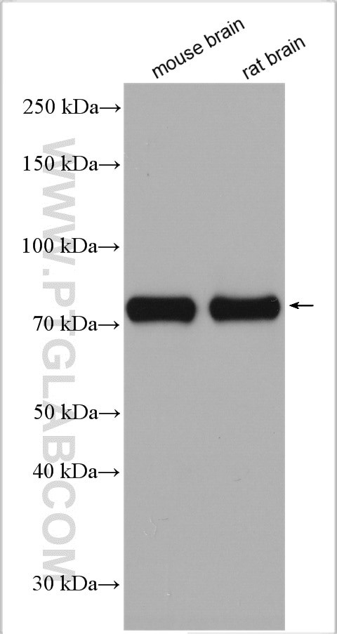 DRP1 (C-terminal) Antibody in Western Blot (WB)