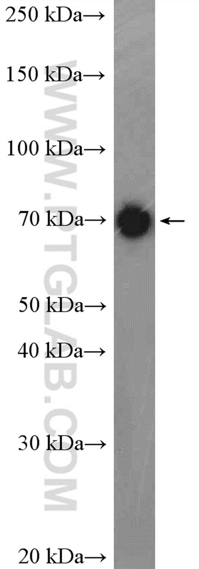 DRP1 (C-terminal) Antibody in Western Blot (WB)