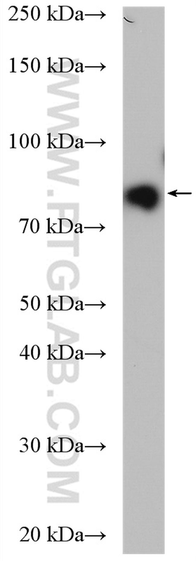 DRP1 (C-terminal) Antibody in Western Blot (WB)