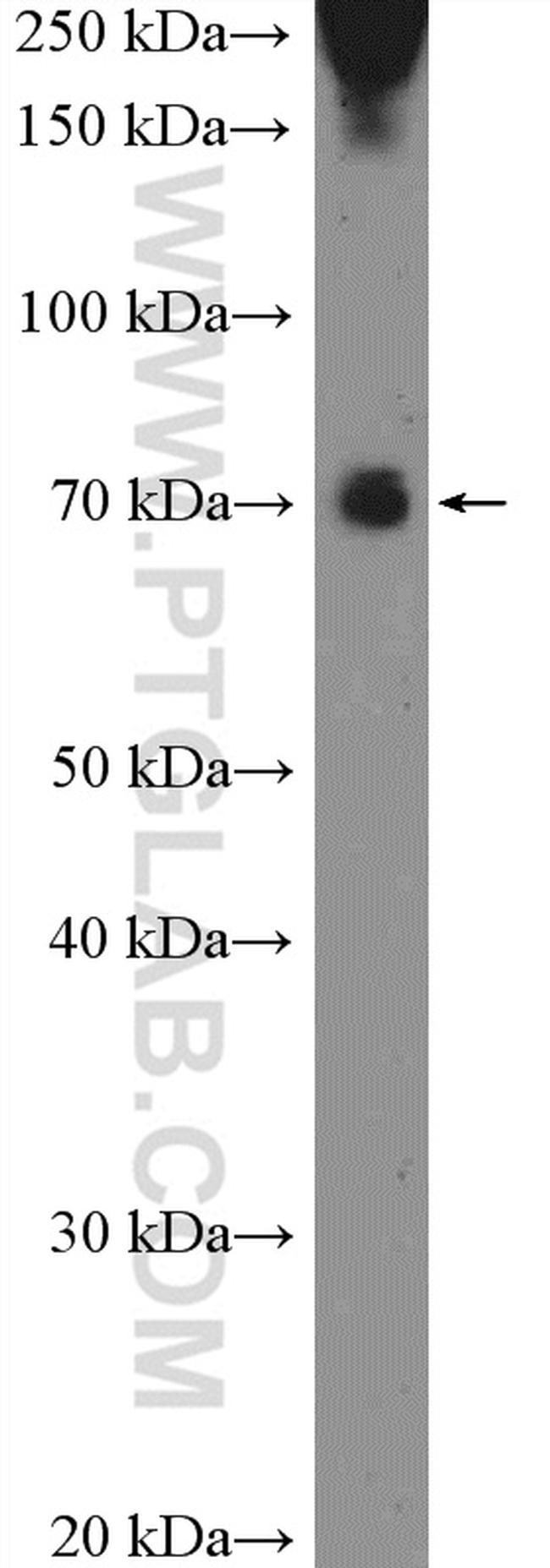 DRP1 (C-terminal) Antibody in Western Blot (WB)