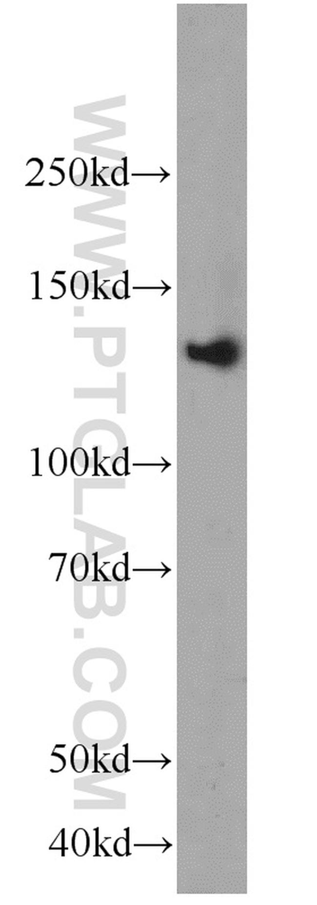 RASGRF1 Antibody in Western Blot (WB)