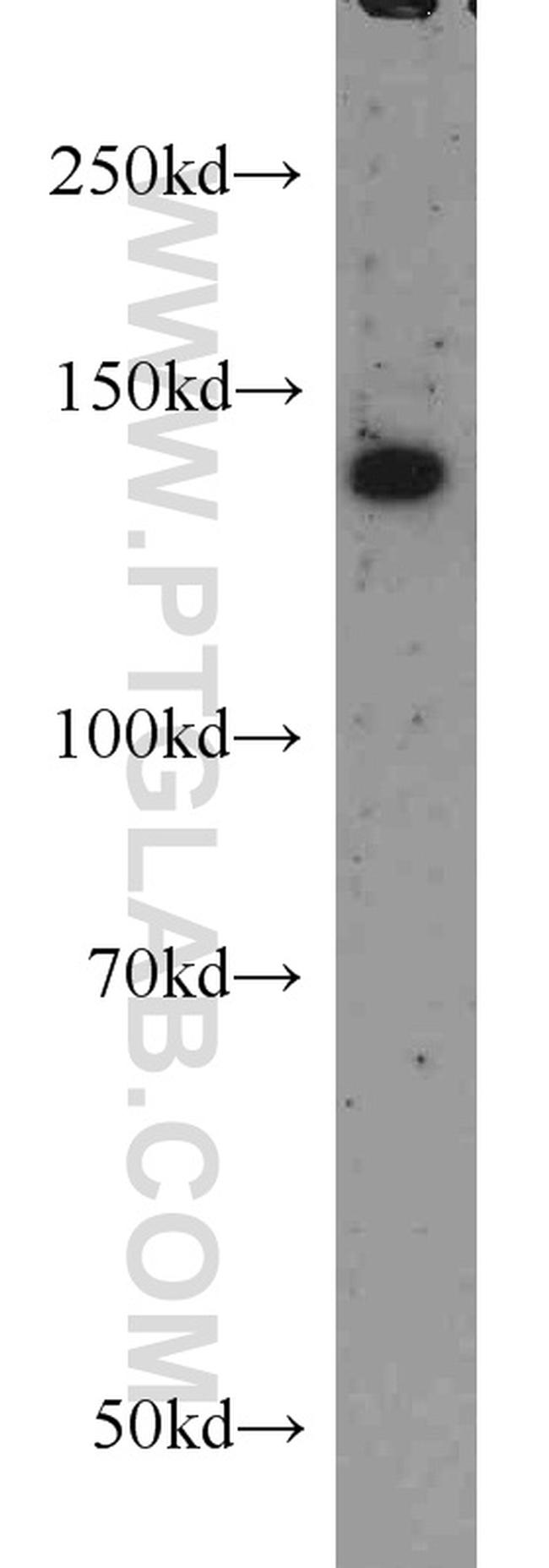 RASGRF1 Antibody in Western Blot (WB)