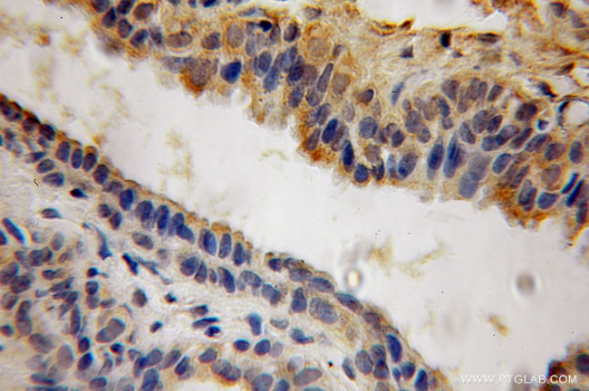 ACP6 Antibody in Immunohistochemistry (Paraffin) (IHC (P))