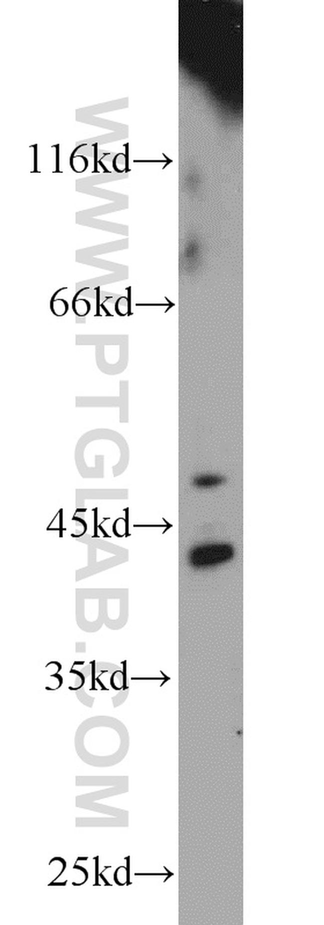 ACP6 Antibody in Western Blot (WB)