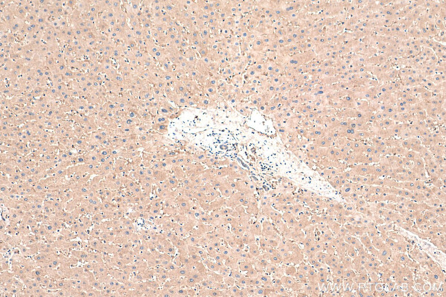 PAICS Antibody in Immunohistochemistry (Paraffin) (IHC (P))