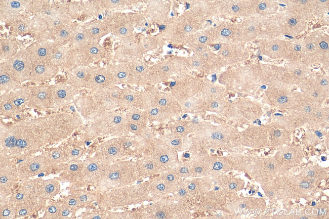 PAICS Antibody in Immunohistochemistry (Paraffin) (IHC (P))