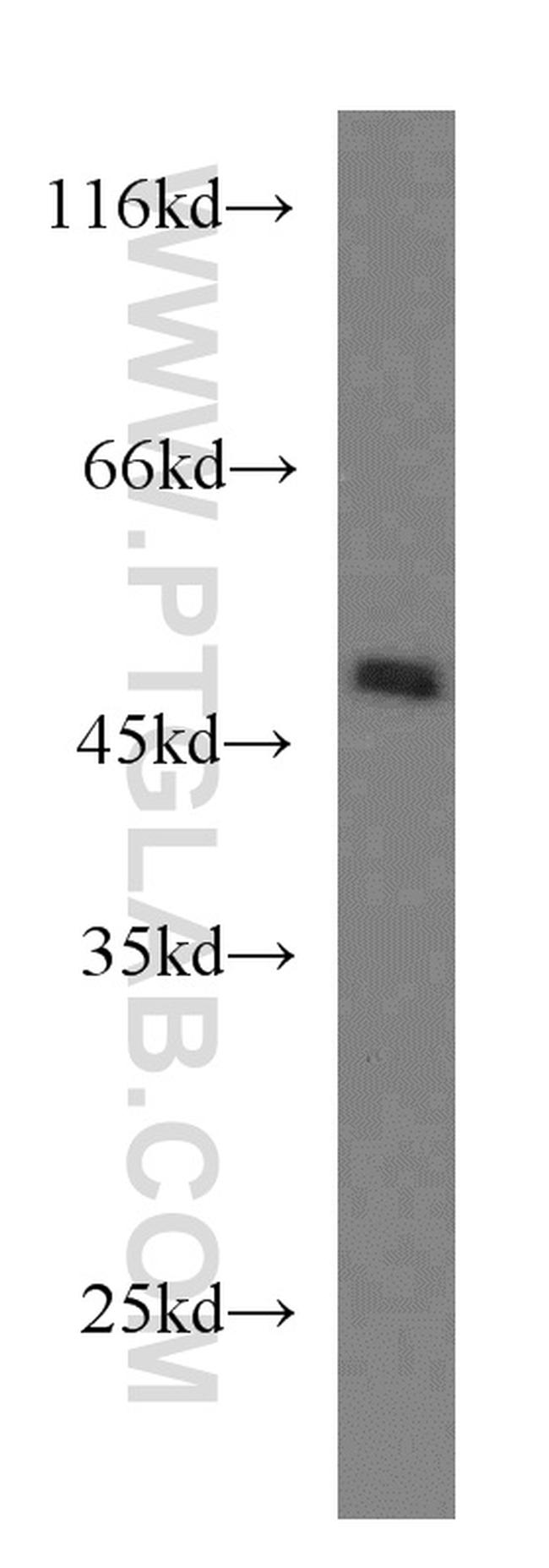 PAICS Antibody in Western Blot (WB)