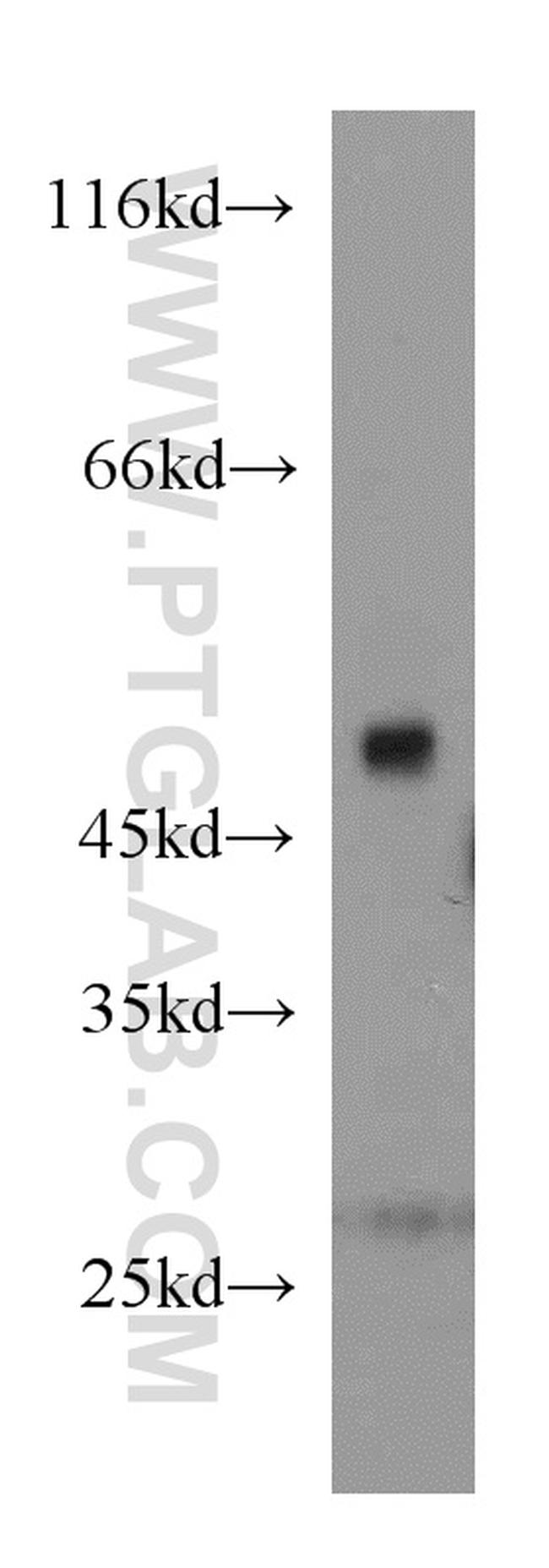 PAICS Antibody in Western Blot (WB)