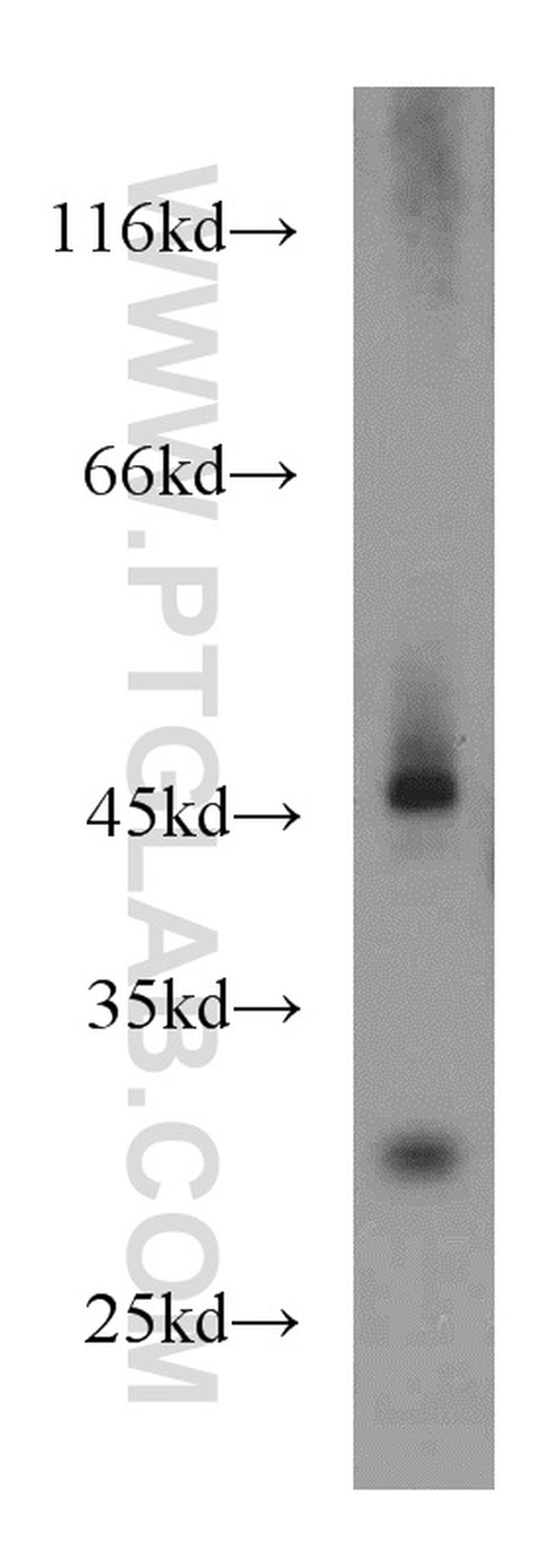 PAICS Antibody in Western Blot (WB)