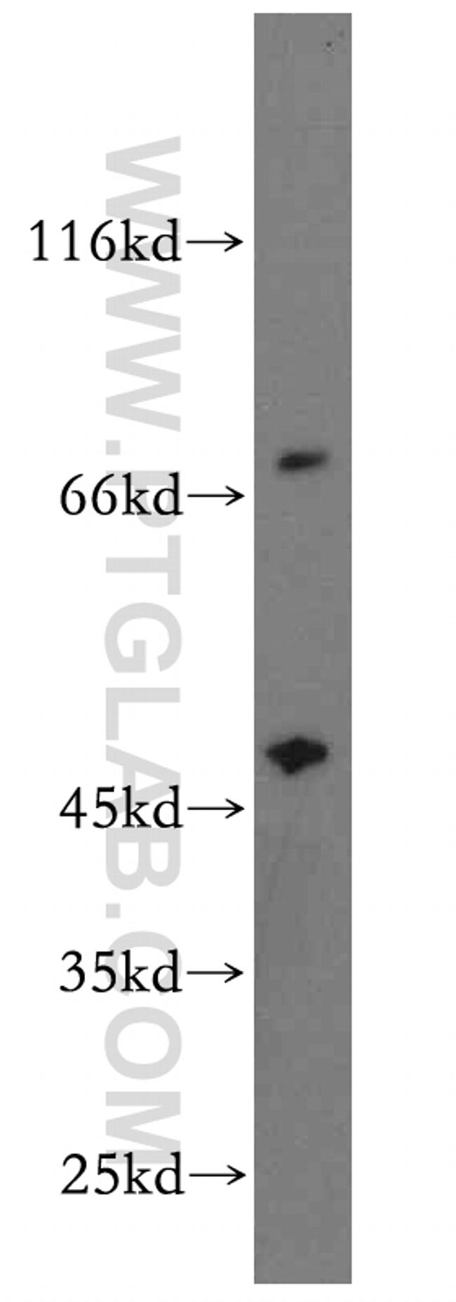 PAICS Antibody in Western Blot (WB)