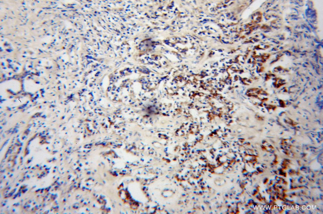 OPRL1 Antibody in Immunohistochemistry (Paraffin) (IHC (P))