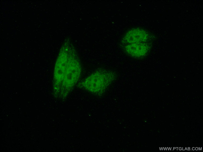 CDC5L Antibody in Immunocytochemistry (ICC/IF)