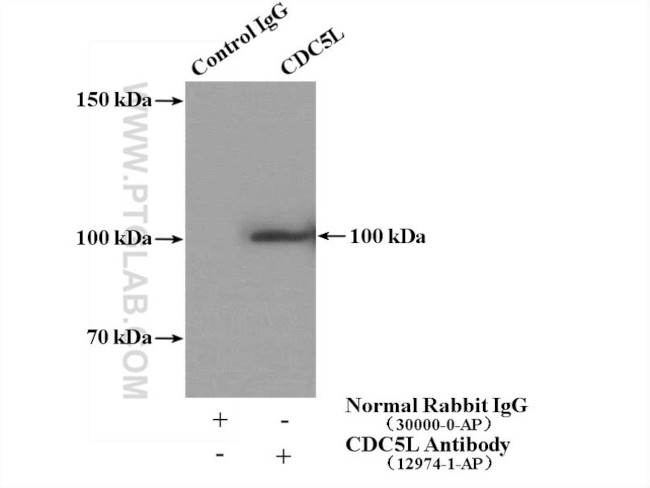 CDC5L Antibody in Immunoprecipitation (IP)