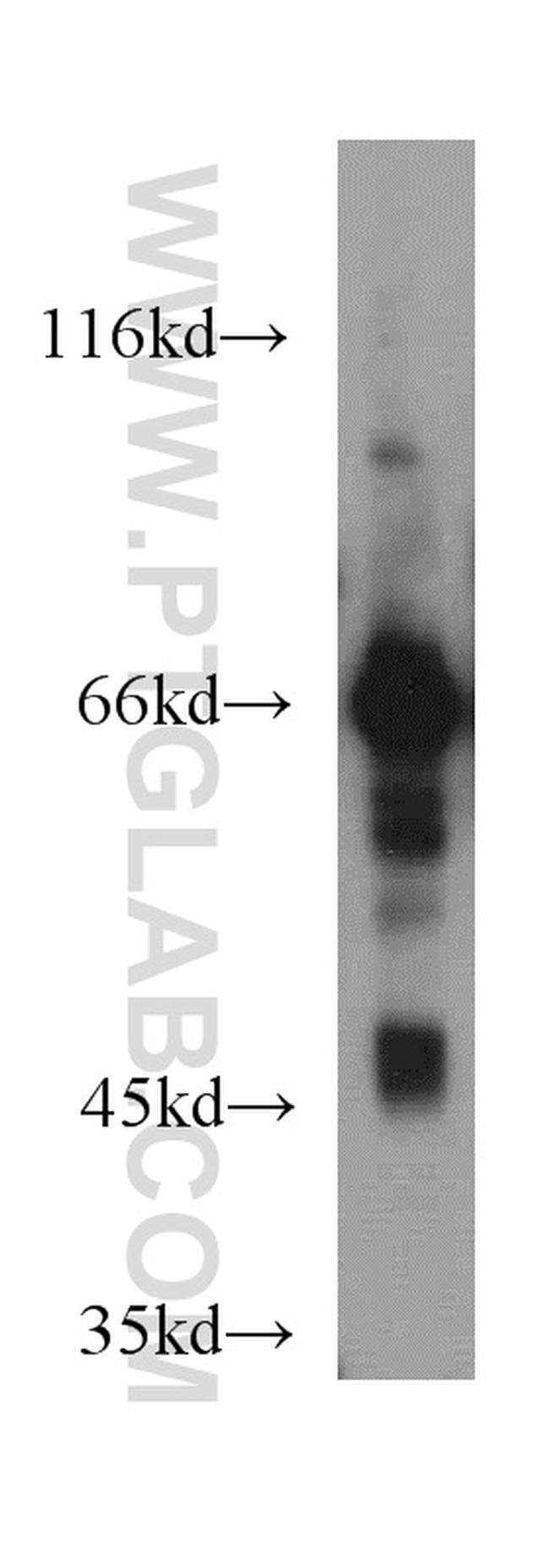 GABRA4 Antibody in Western Blot (WB)