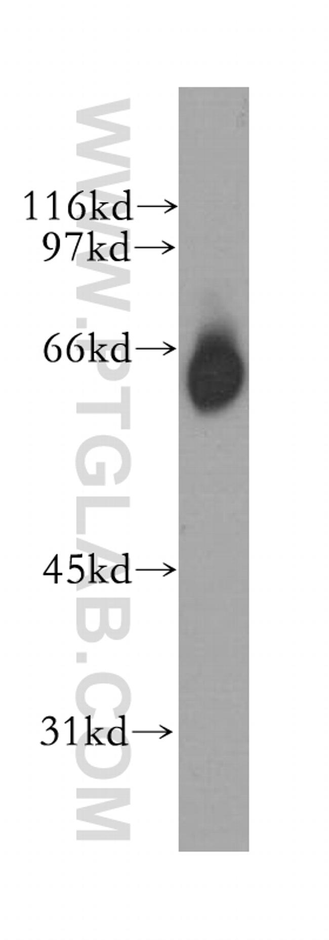 GABRA4 Antibody in Western Blot (WB)