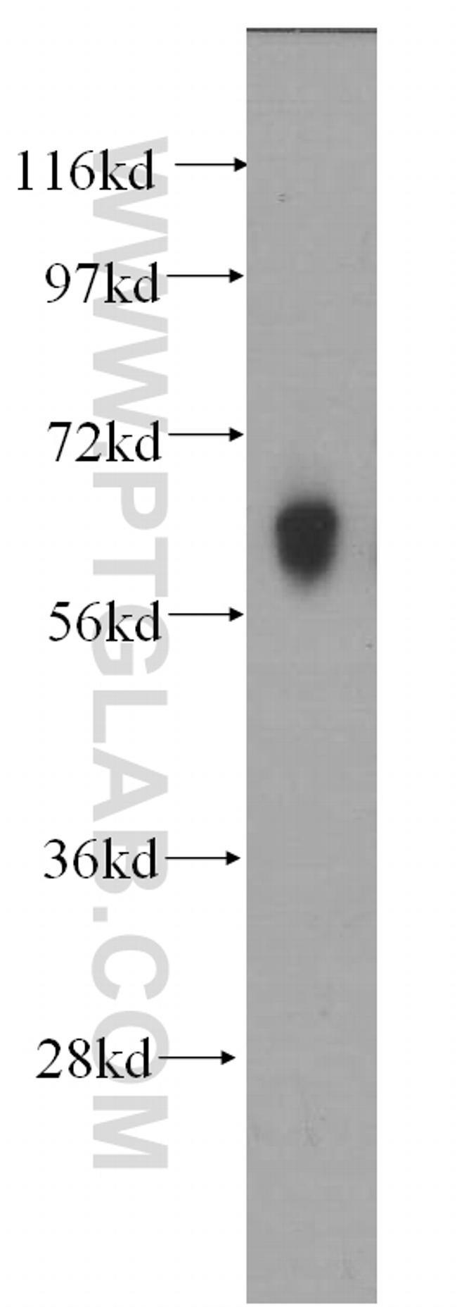 GABRA4 Antibody in Western Blot (WB)