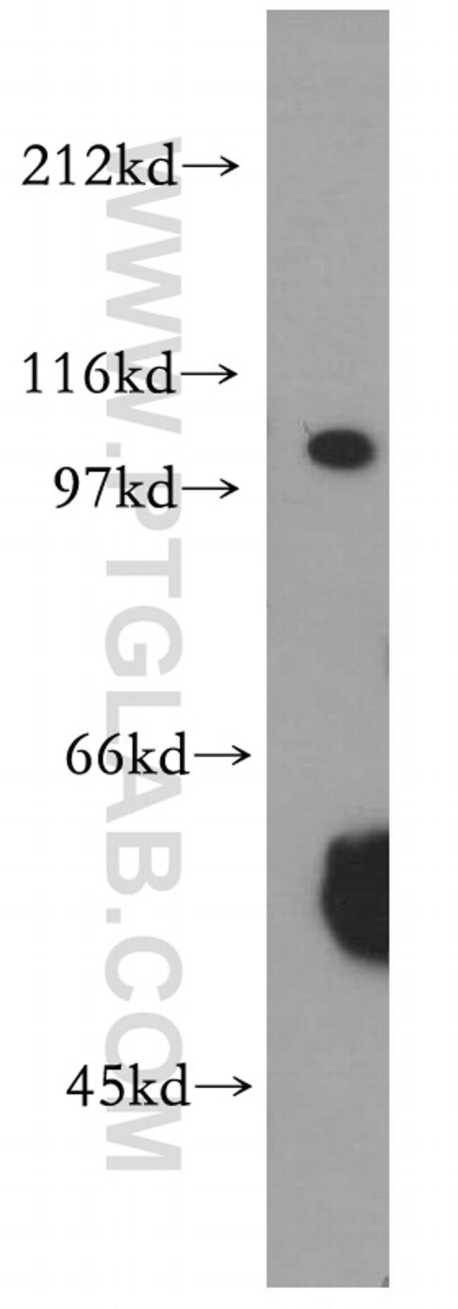 XPO7 Antibody in Western Blot (WB)