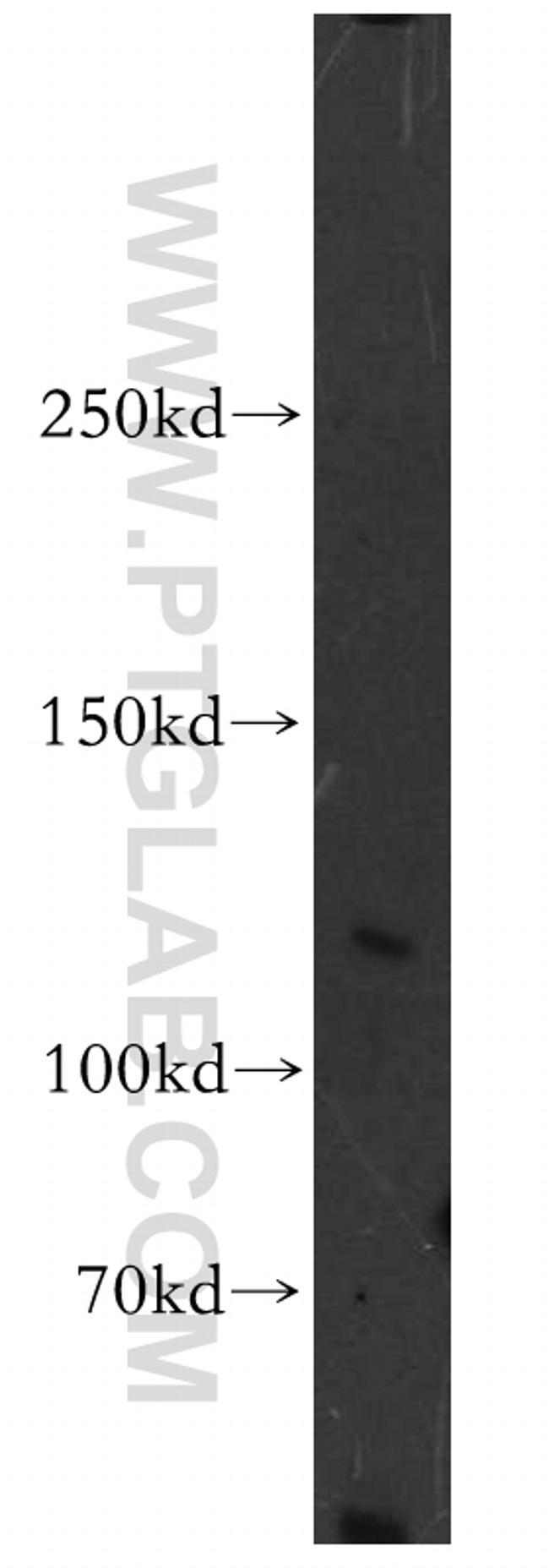 XPO7 Antibody in Western Blot (WB)