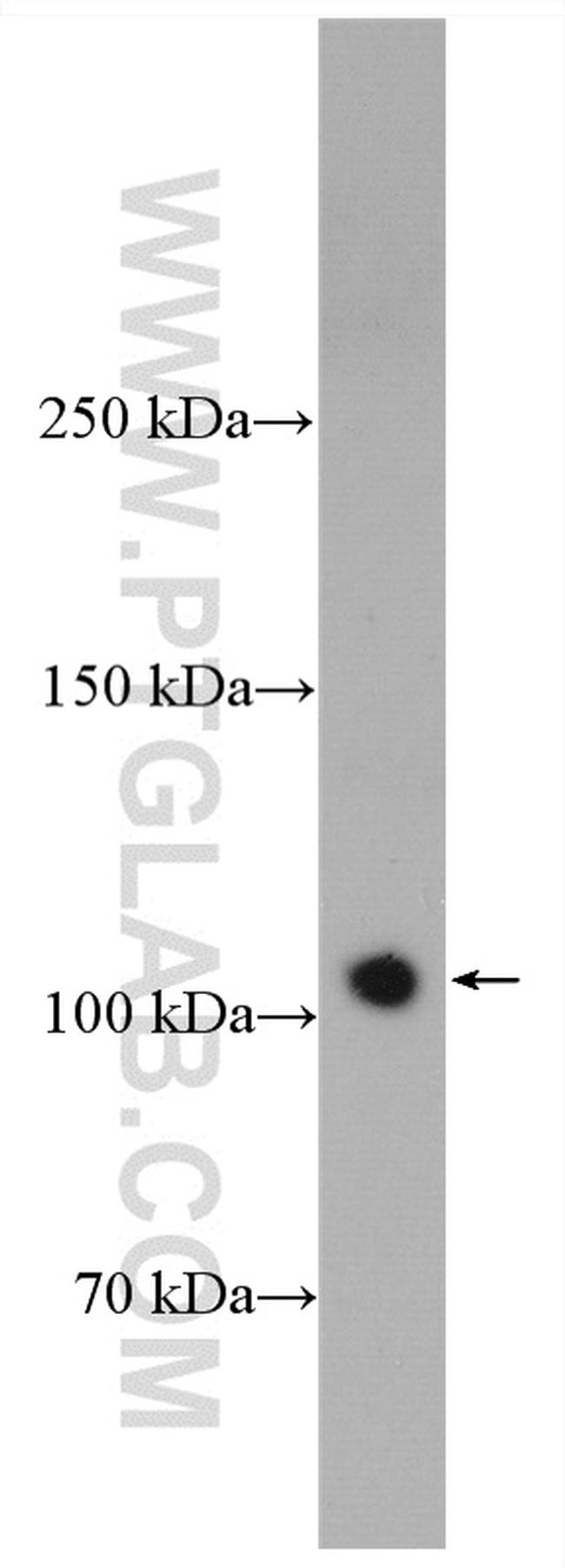 XPO7 Antibody in Western Blot (WB)