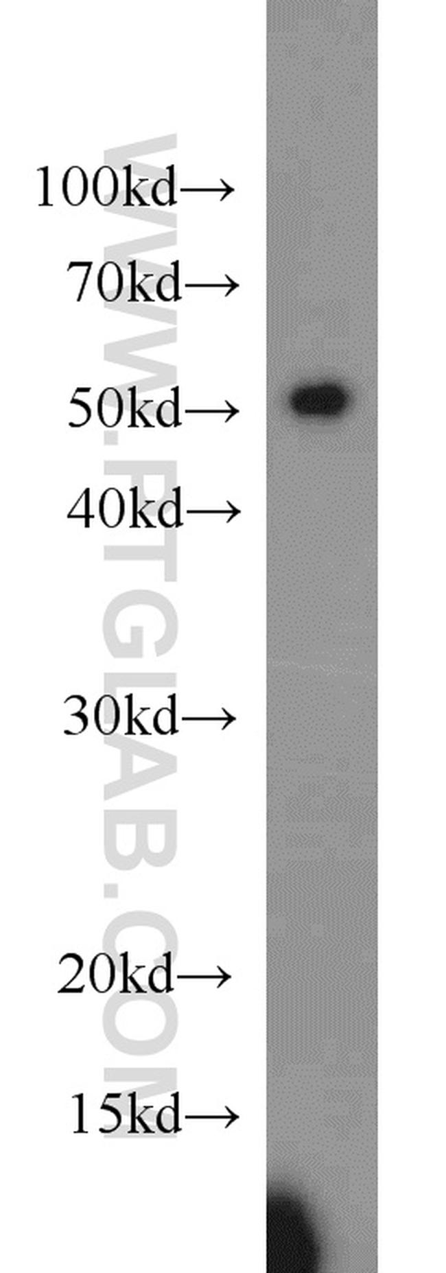 PHD1 Antibody in Western Blot (WB)