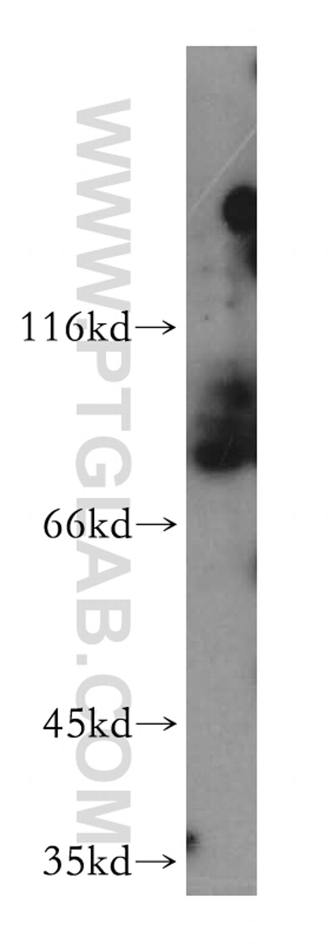 PPIG Antibody in Western Blot (WB)