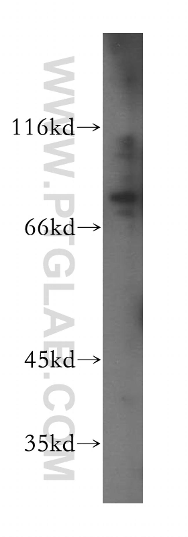 PPIG Antibody in Western Blot (WB)