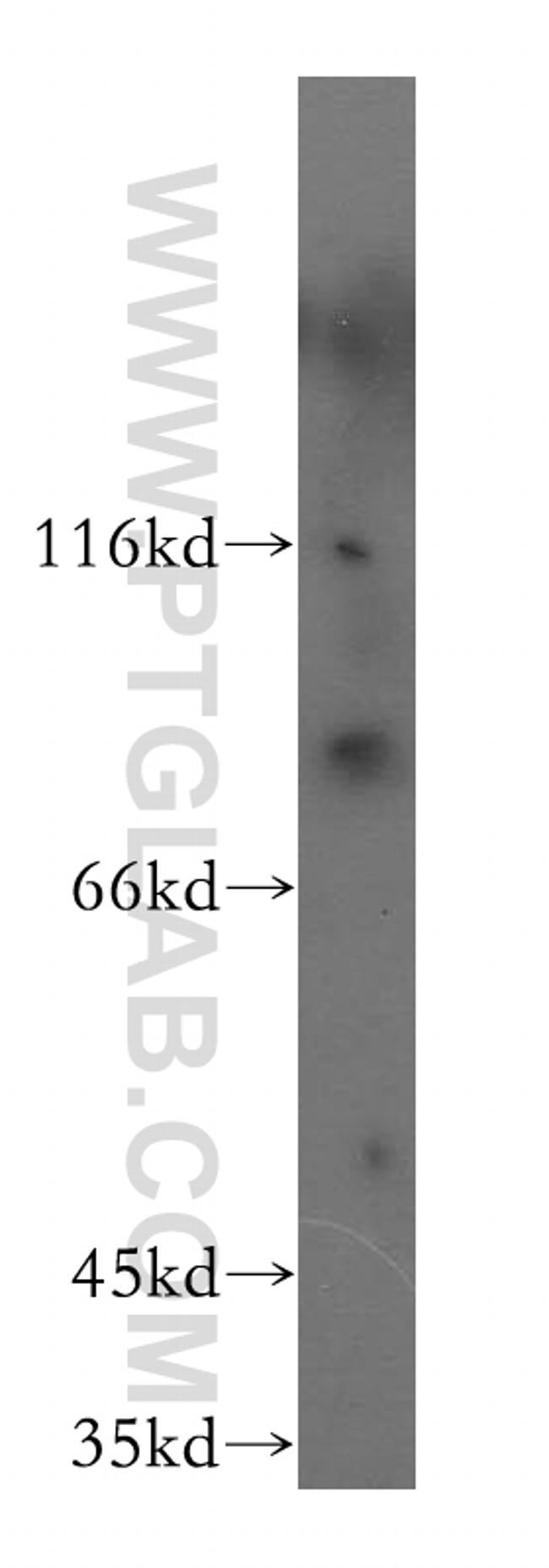 PPIG Antibody in Western Blot (WB)