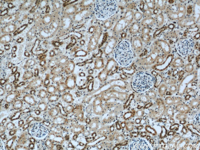 Lamin B1 Antibody in Immunohistochemistry (Paraffin) (IHC (P))