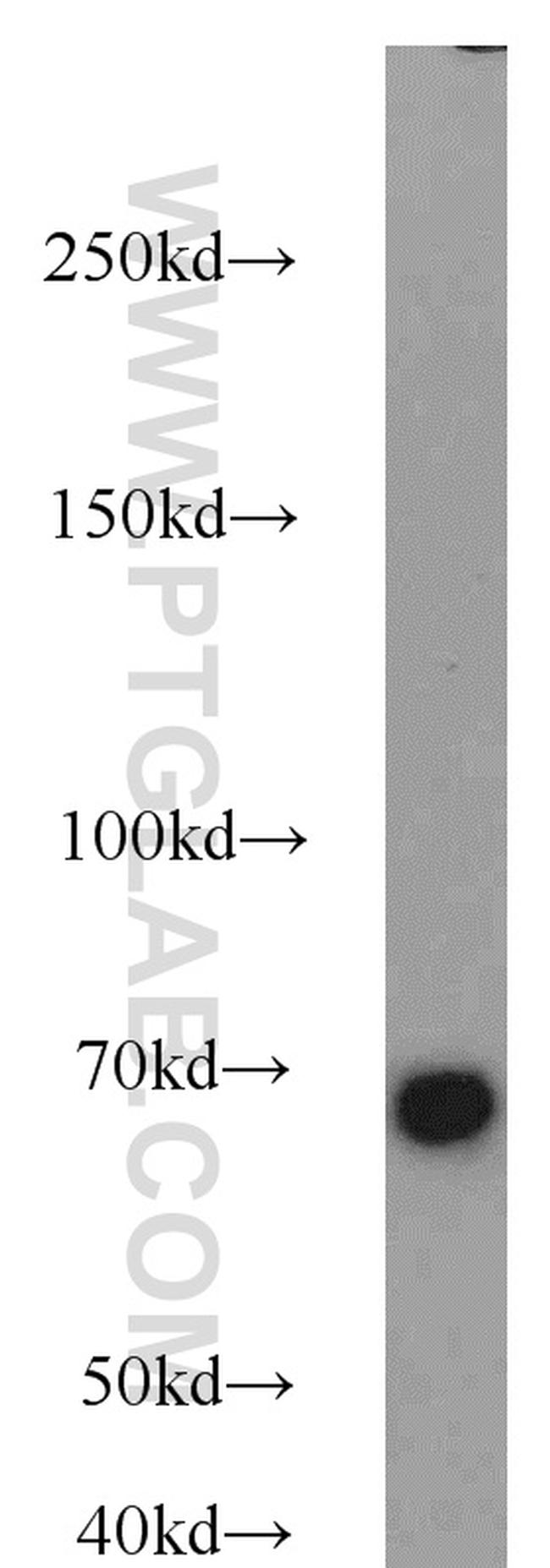 Lamin B1 Antibody in Western Blot (WB)