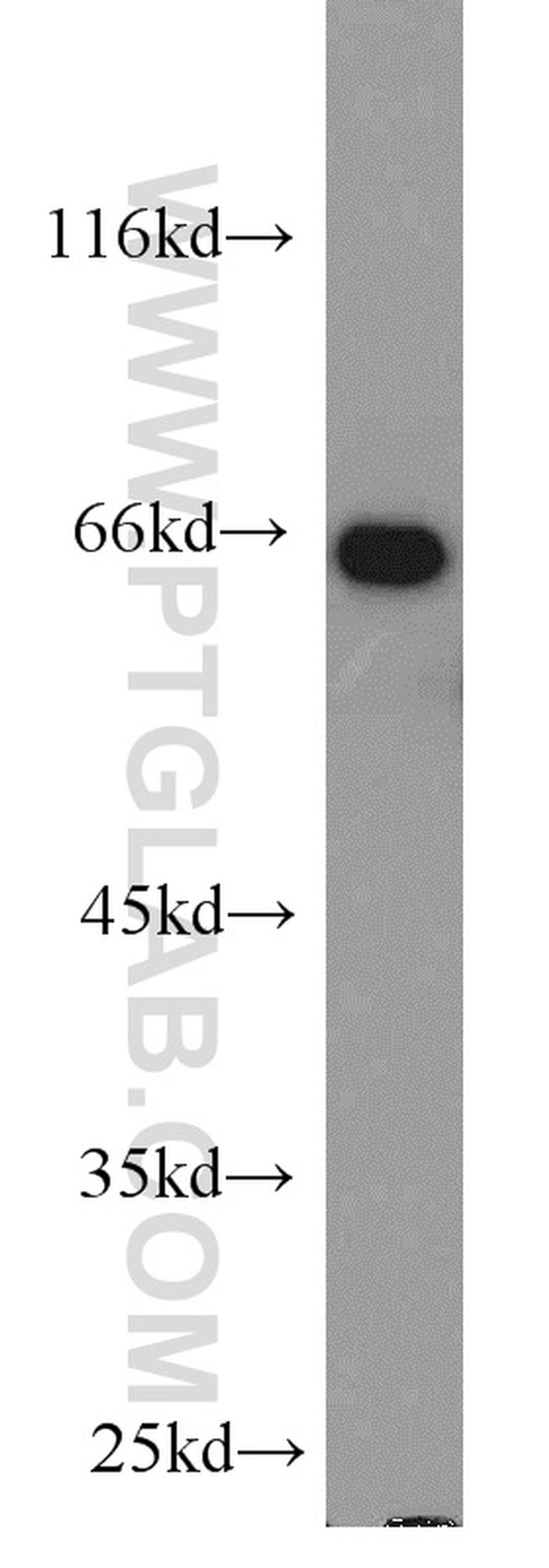 Lamin B1 Antibody in Western Blot (WB)