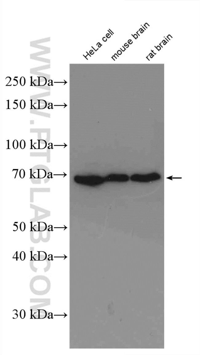 Lamin B1 Antibody in Western Blot (WB)