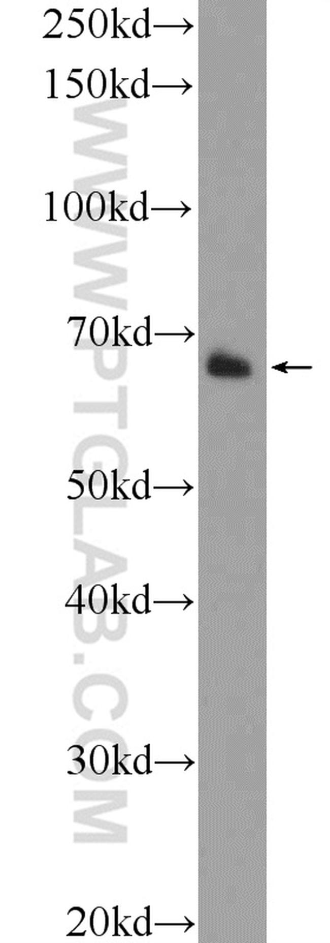 Lamin B1 Antibody in Western Blot (WB)