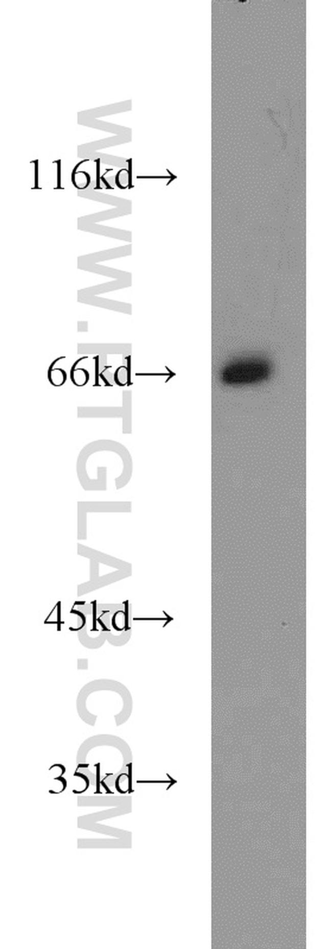 Lamin B1 Antibody in Western Blot (WB)