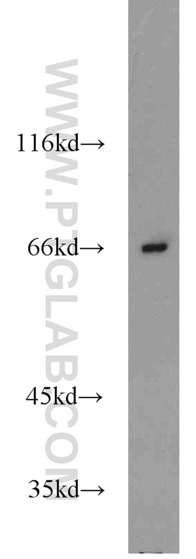 Lamin B1 Antibody in Western Blot (WB)