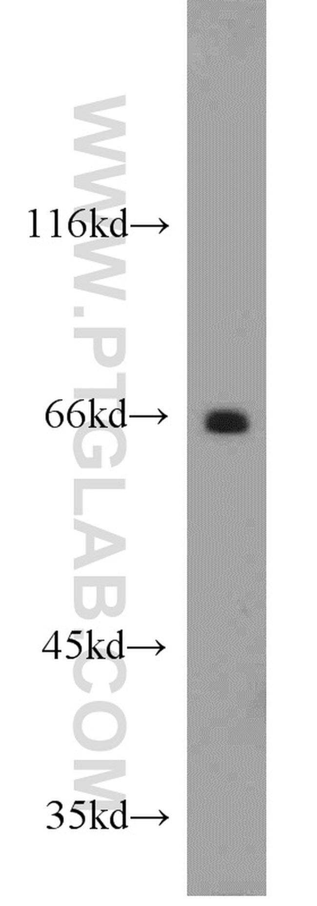 Lamin B1 Antibody in Western Blot (WB)