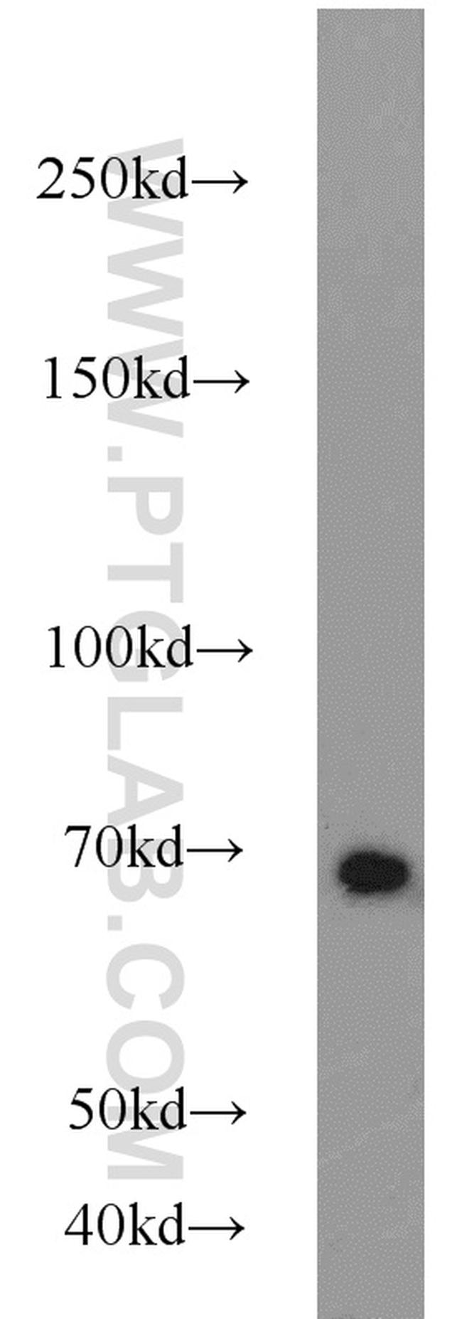 Lamin B1 Antibody in Western Blot (WB)