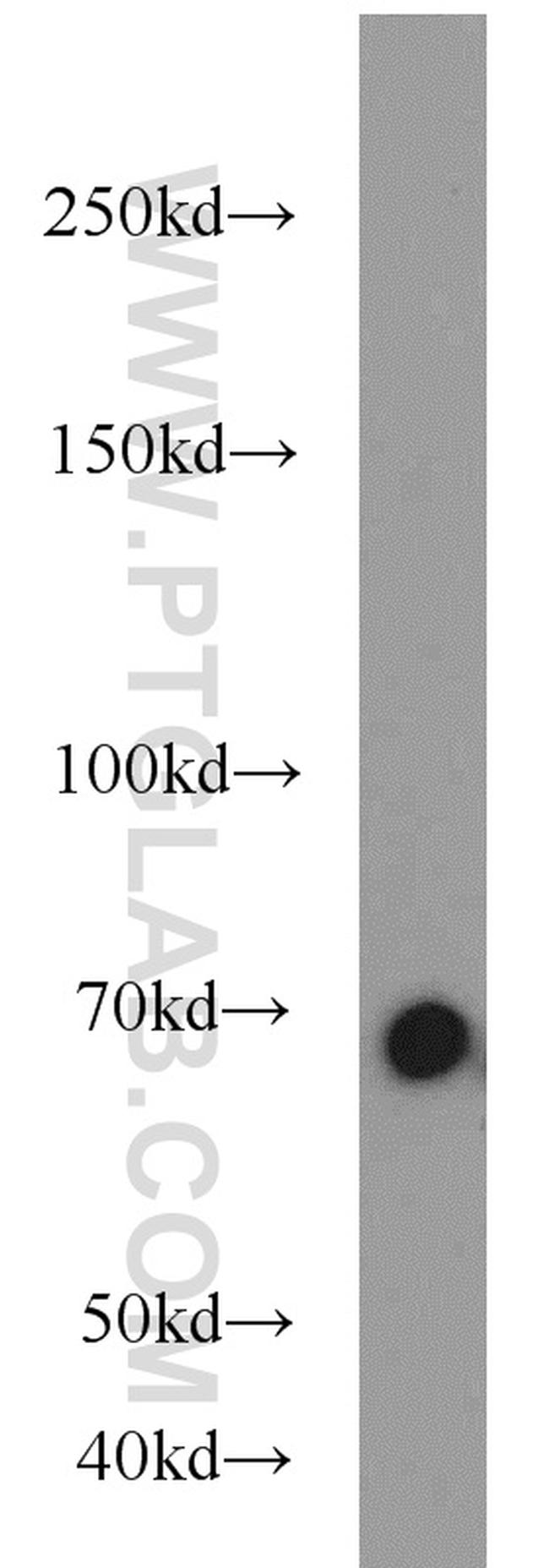 Lamin B1 Antibody in Western Blot (WB)