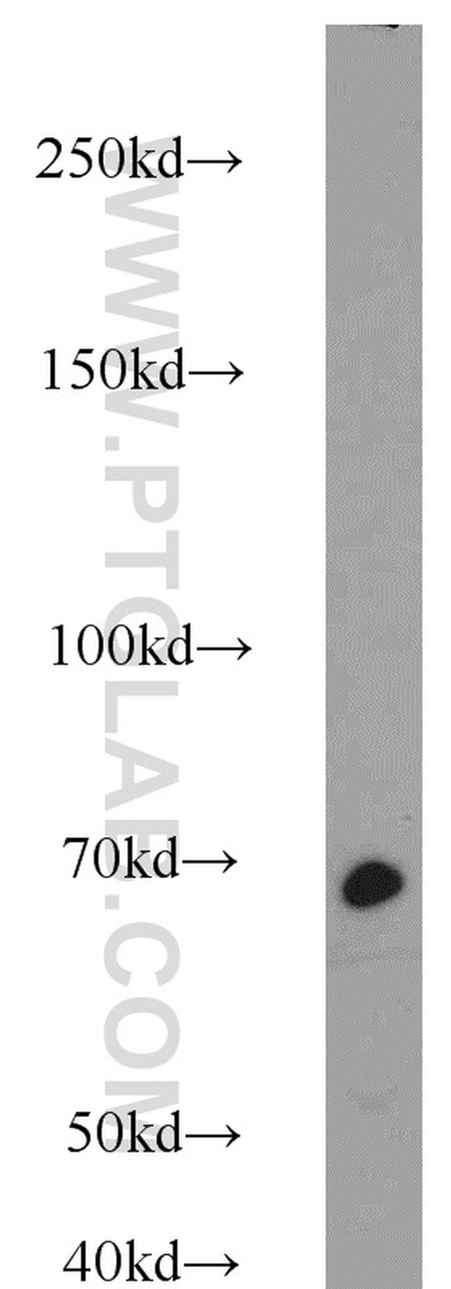 Lamin B1 Antibody in Western Blot (WB)