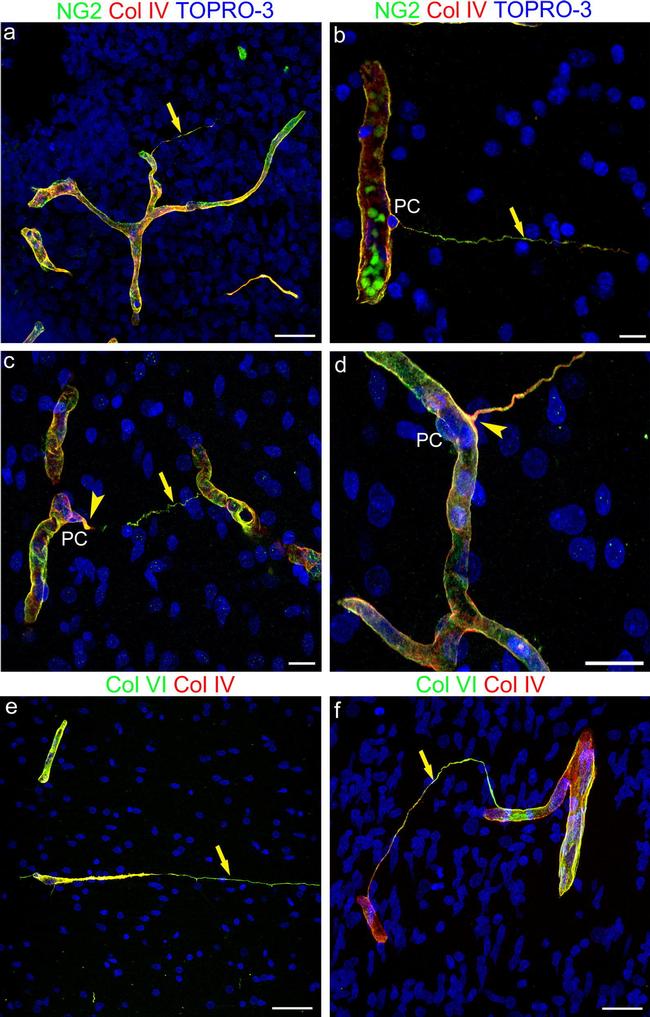 Neural/Glial Antigen 2 (NG2) Antibody in Immunocytochemistry (ICC/IF)