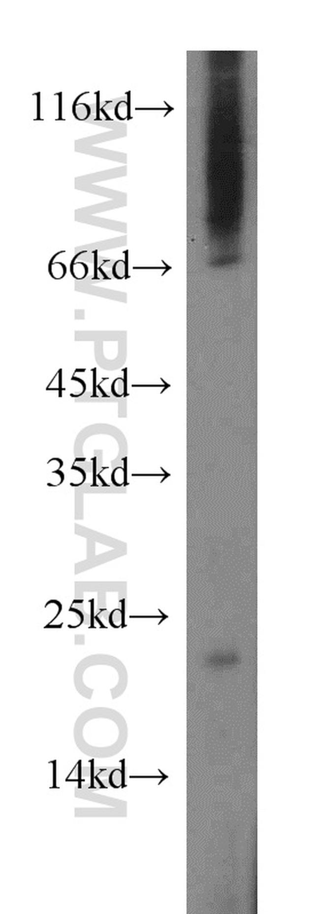 ARMER Antibody in Western Blot (WB)