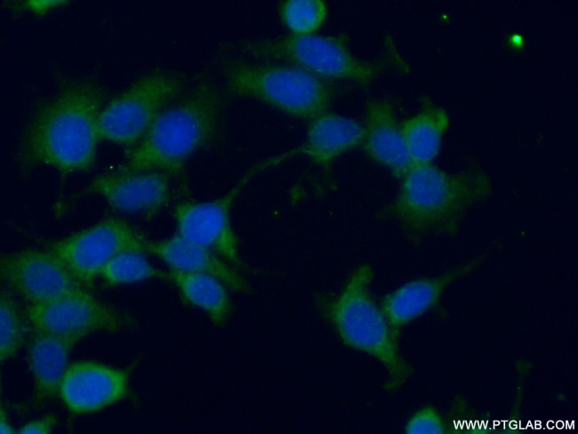 GSPT2 Antibody in Immunocytochemistry (ICC/IF)