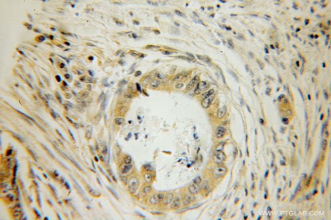 GSPT2 Antibody in Immunohistochemistry (Paraffin) (IHC (P))