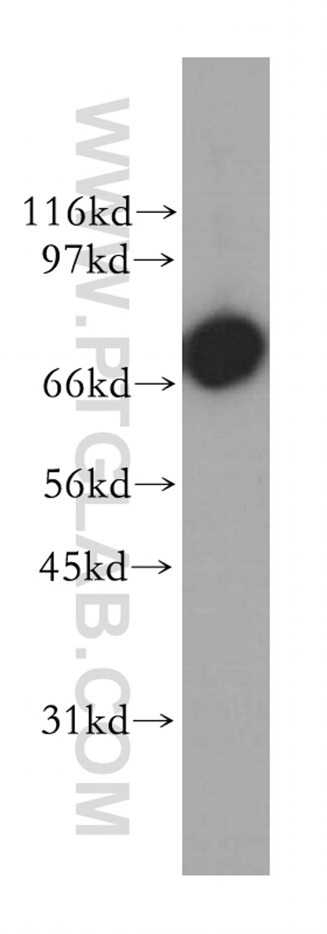 GSPT2 Antibody in Western Blot (WB)