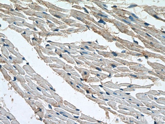 SIRT7 Antibody in Immunohistochemistry (Paraffin) (IHC (P))