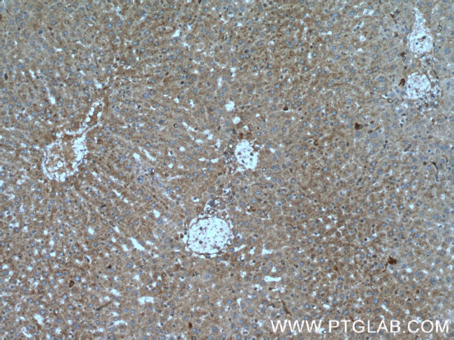 SIRT7 Antibody in Immunohistochemistry (Paraffin) (IHC (P))