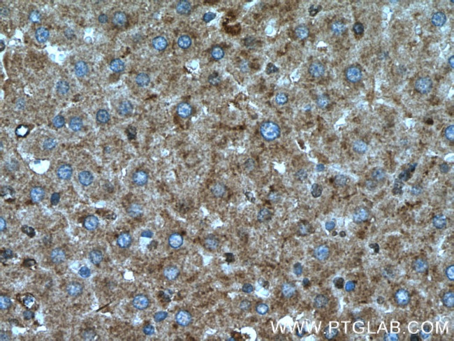 SIRT7 Antibody in Immunohistochemistry (Paraffin) (IHC (P))