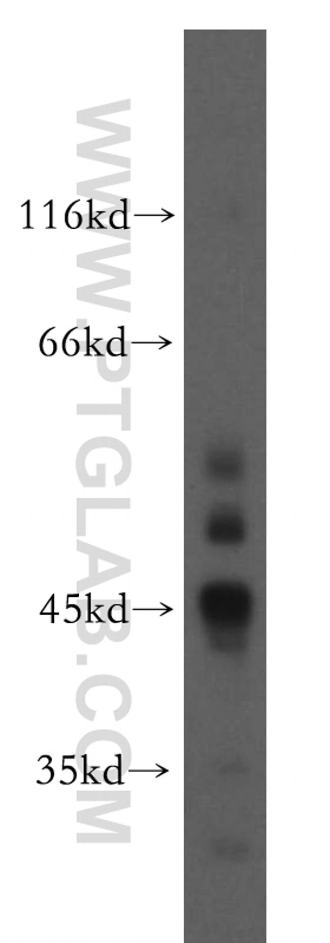 SIRT7 Antibody in Western Blot (WB)