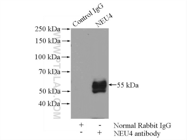 NEU4 Antibody in Immunoprecipitation (IP)