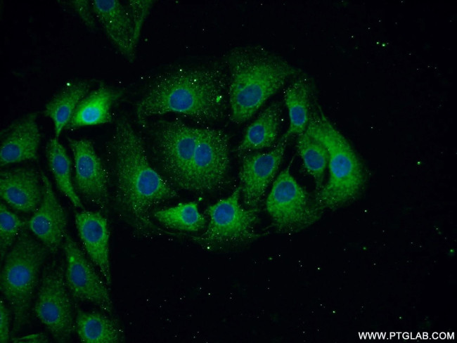 NF-L Antibody in Immunocytochemistry (ICC/IF)